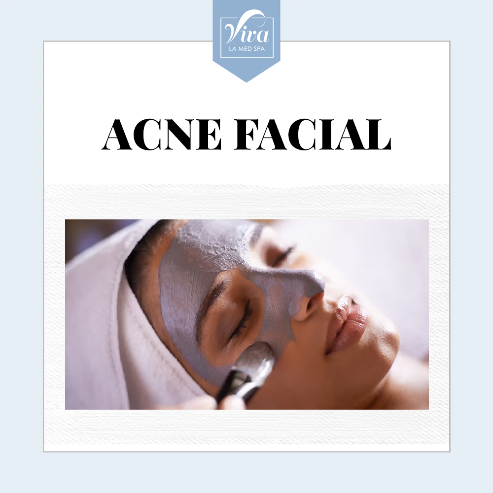 Acne Facial