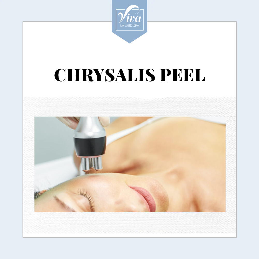 Chrysalis Peel