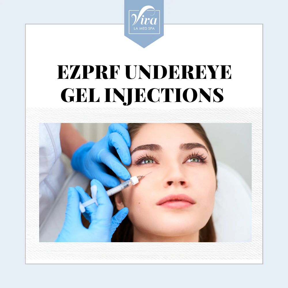 EZ PRF Under Eye Gel Injections