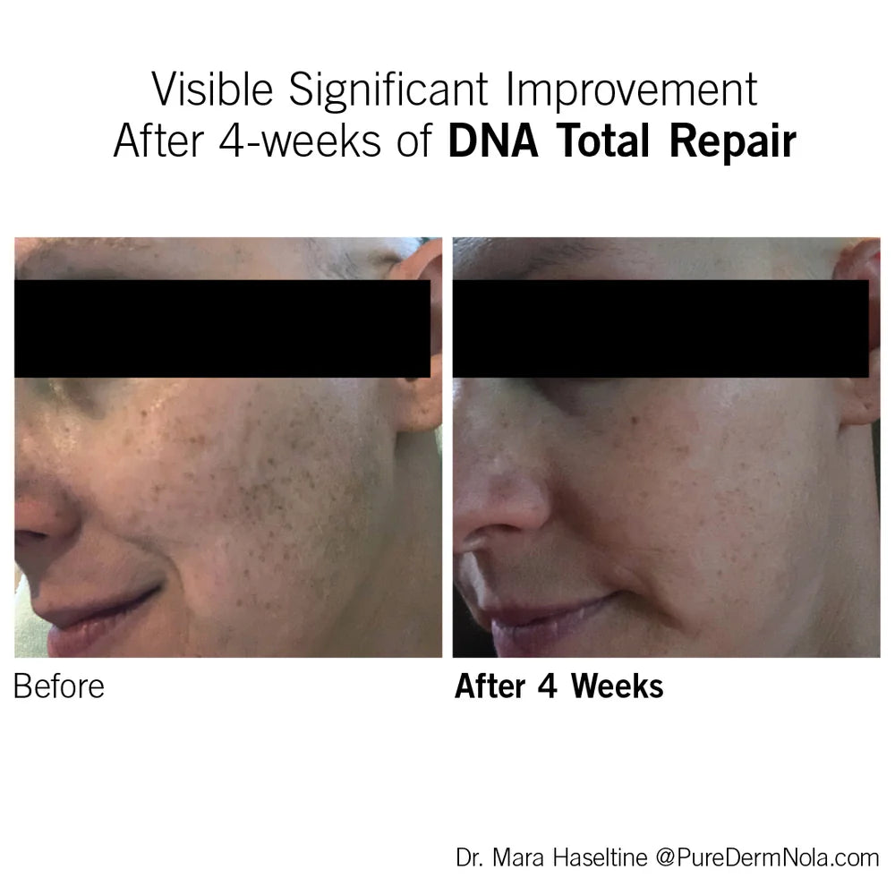 Neova DNA Total Repair