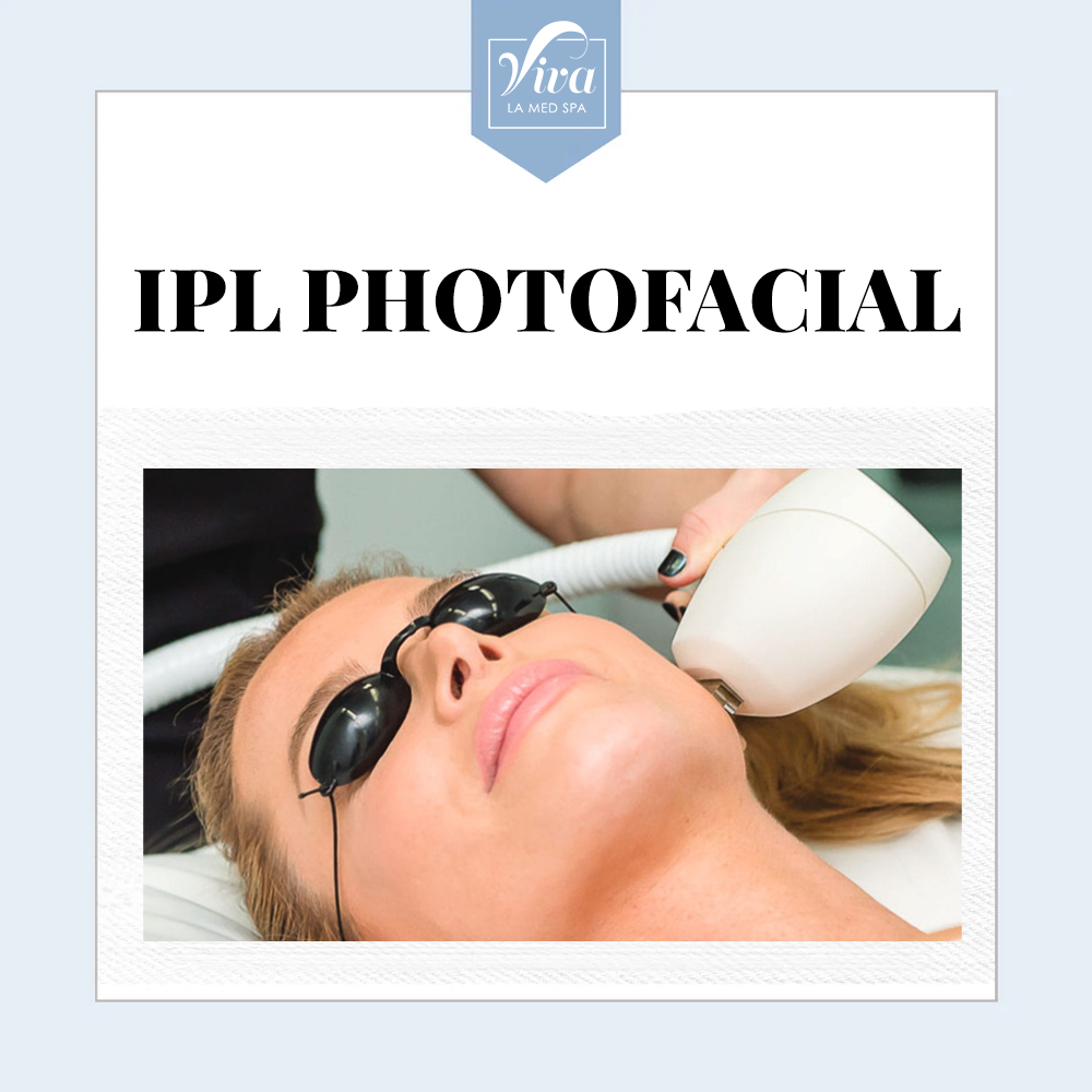 IPL Photofacial (Décolletage(Neck & Chest))