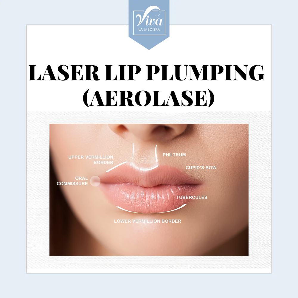 Laser Lip Plumping (Aerolase)