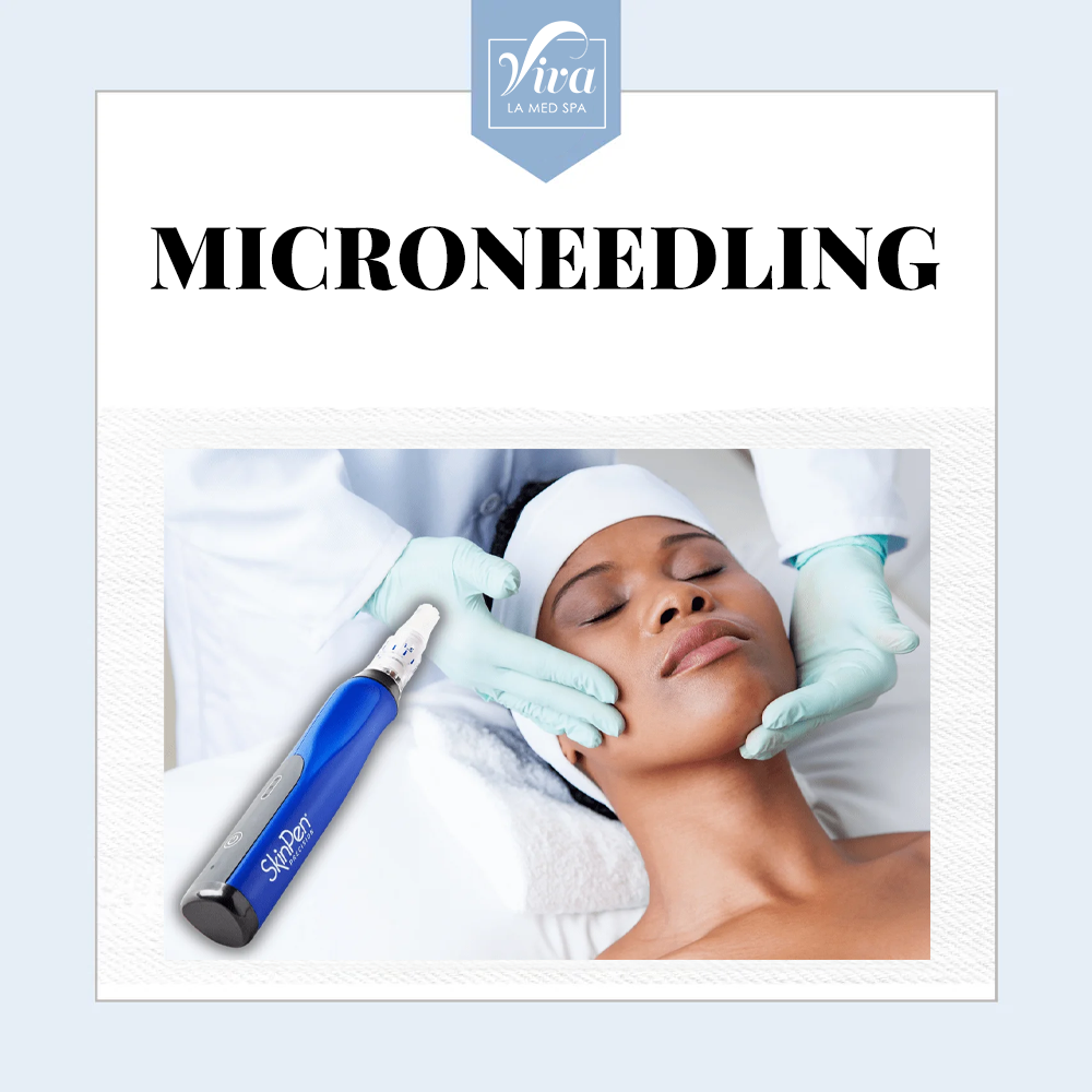 Microneedling