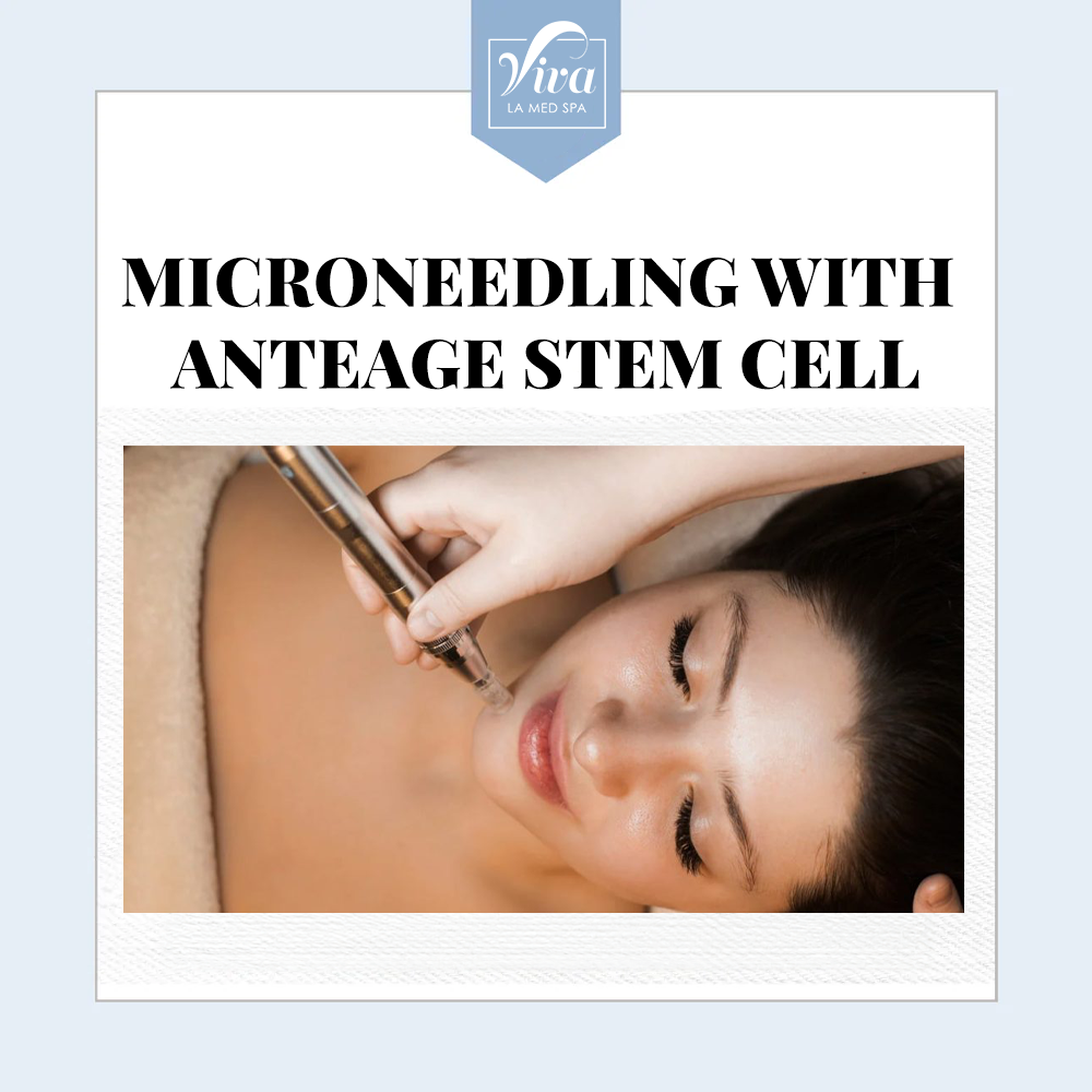 Microneedling with Anteage Stem Cell