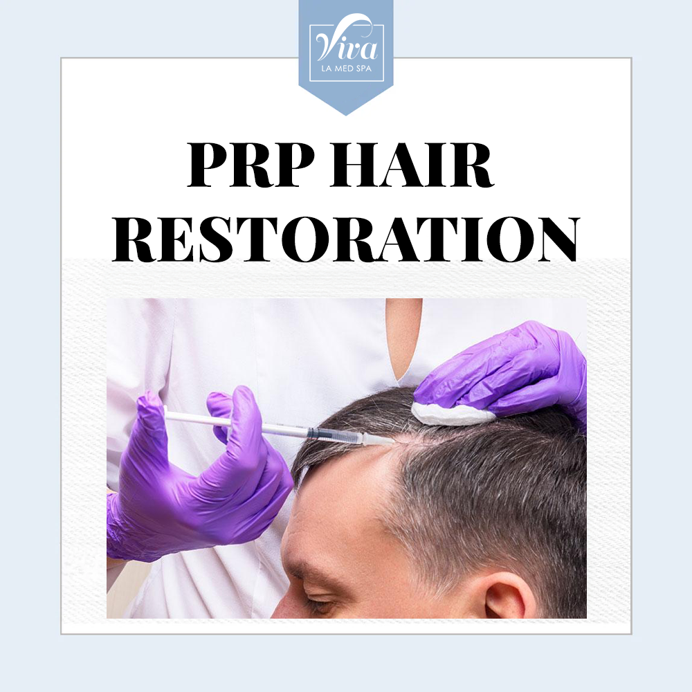 PRP Hair Restoration