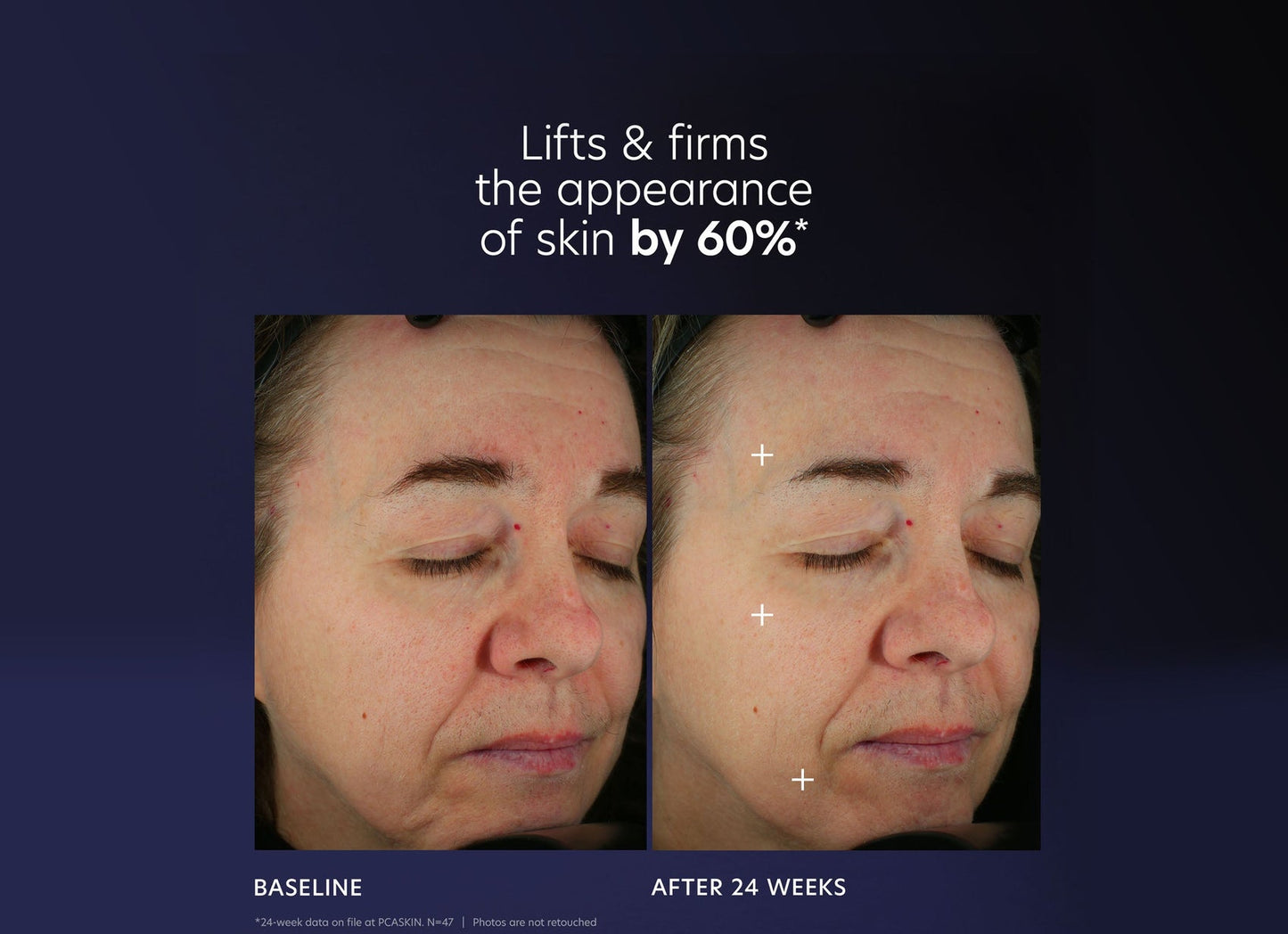 PCASkin Pro-Max Age Renewal