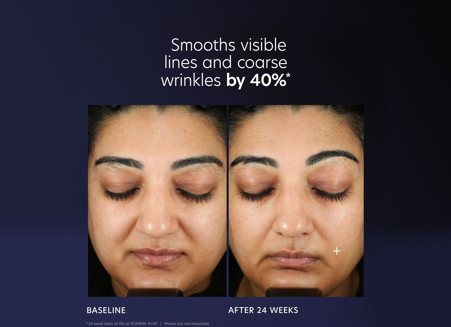PCASkin Pro-Max Age Renewal