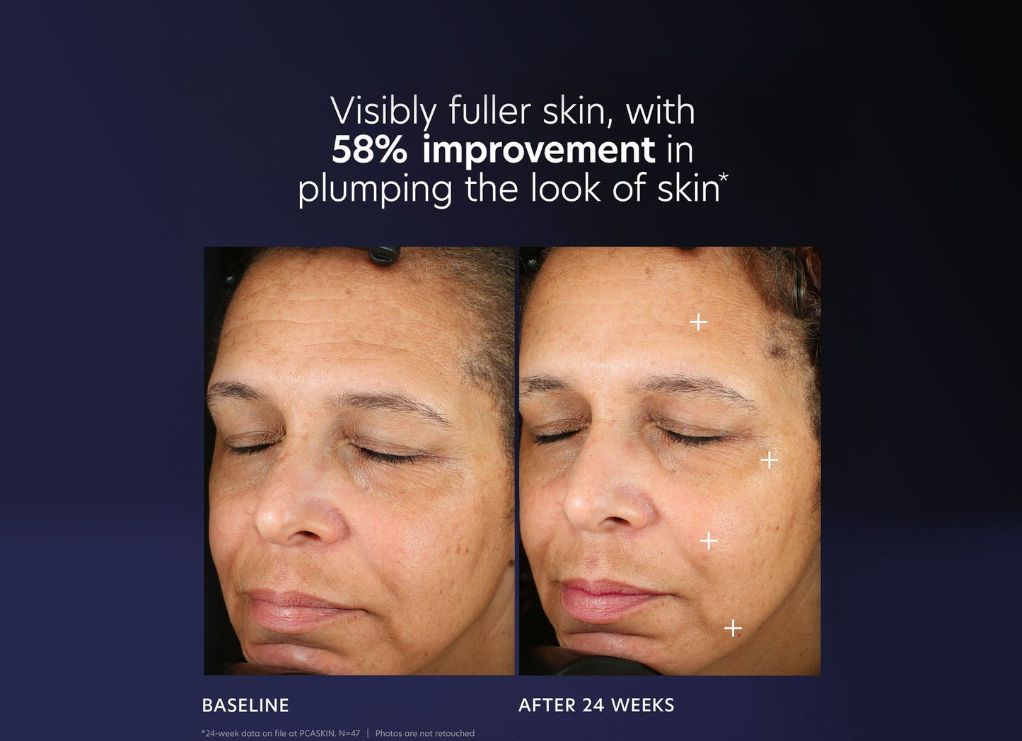 PCASkin Pro-Max Age Renewal