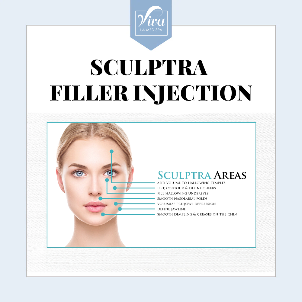 Sculptra Filler Injection