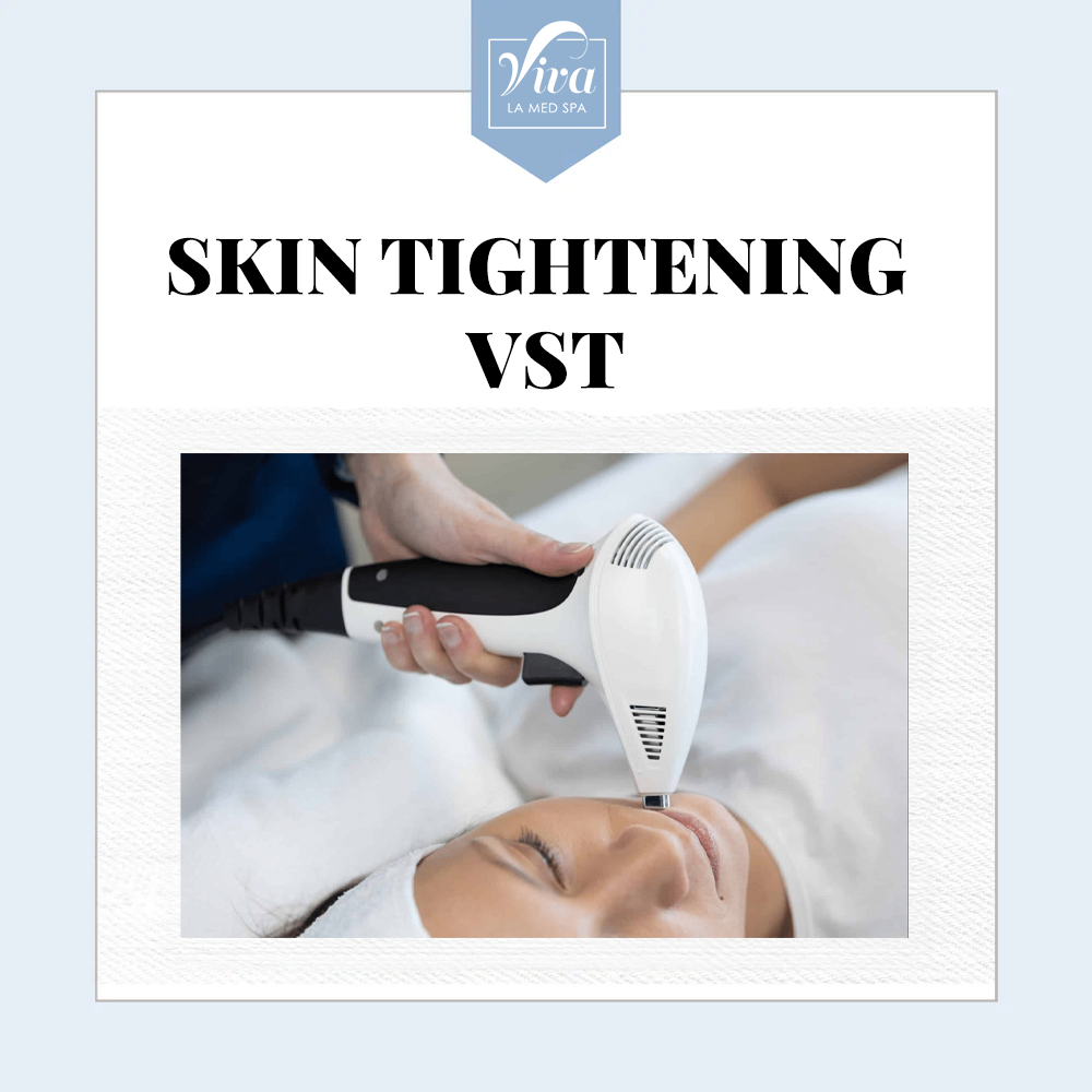 Skin Tightening VST