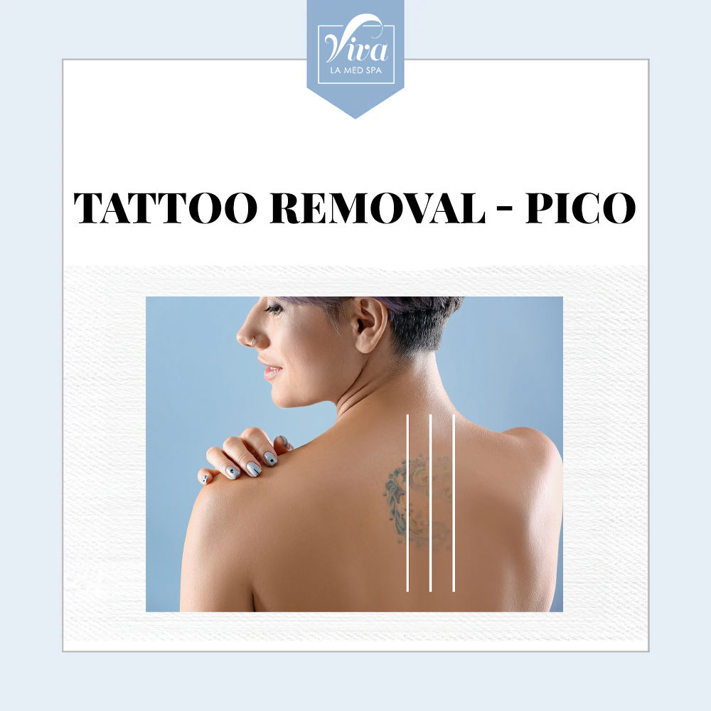 Tattoo Removal - Pico Laser