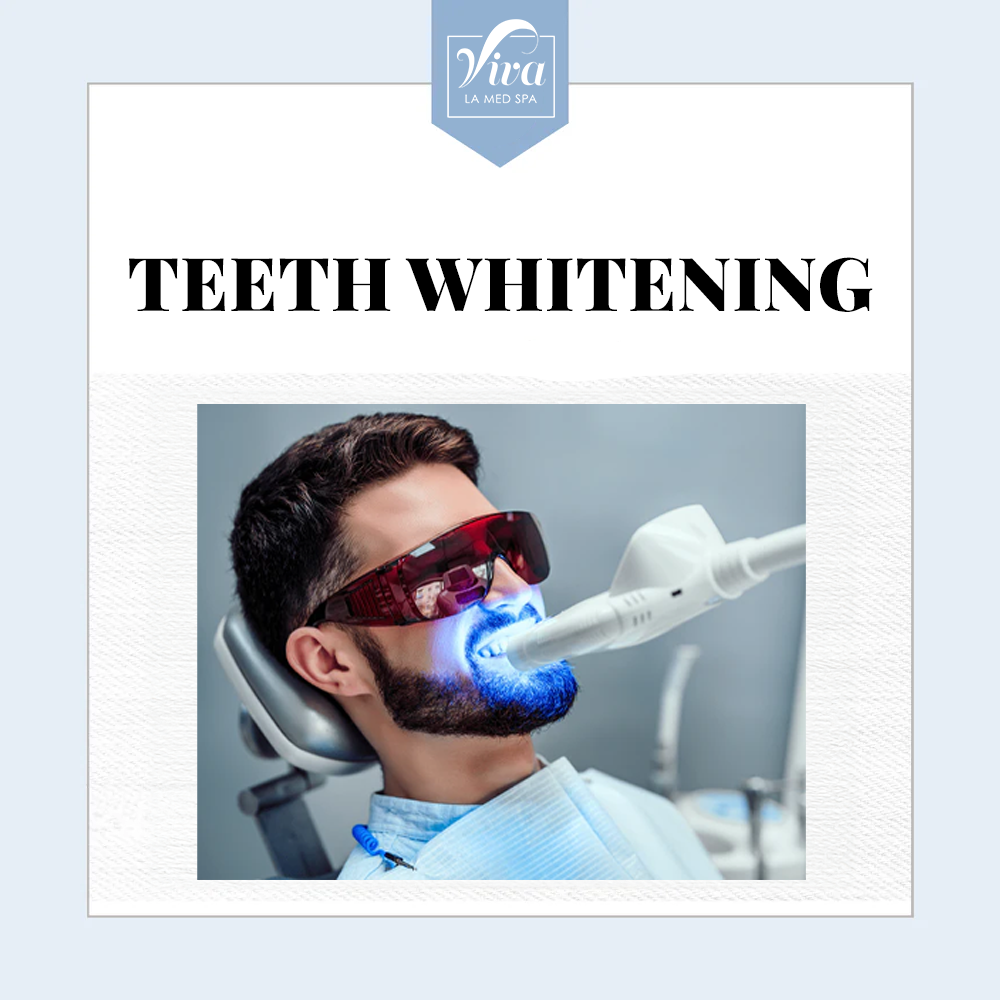 Teeth Whitening