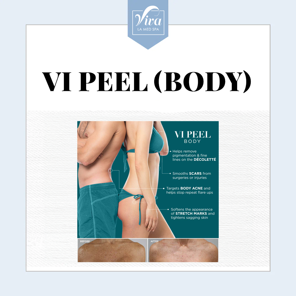 VI Peel (Body) Large Area