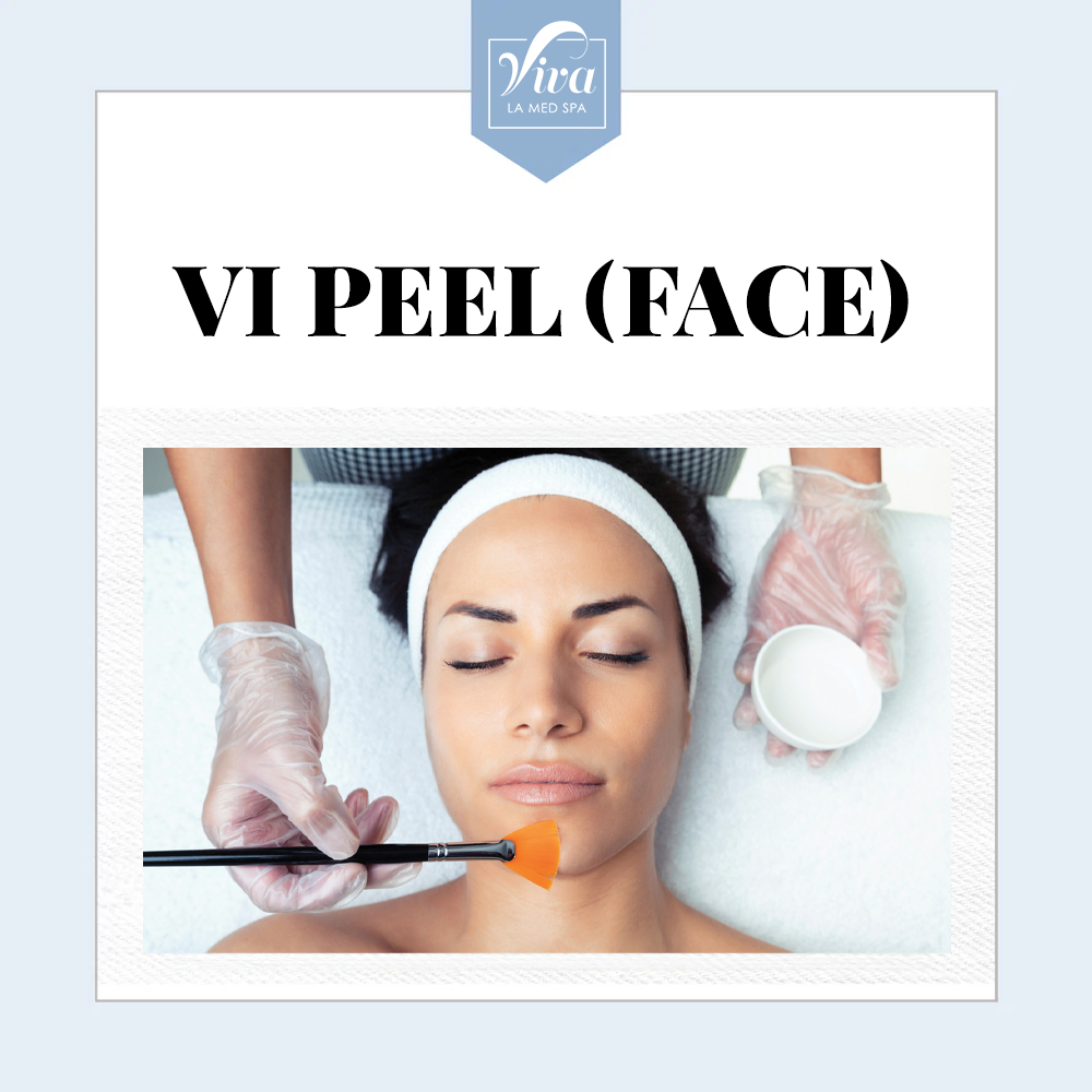 VI Peel (Face)