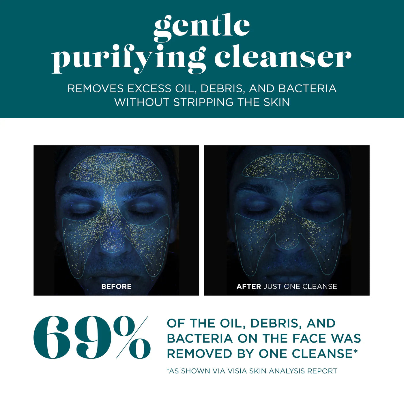 VI Derm Gentle Purifying Cleanser