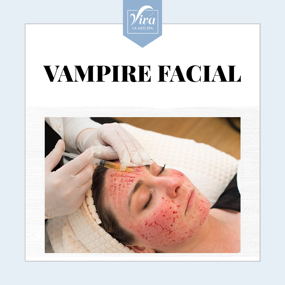 Vampire Facial