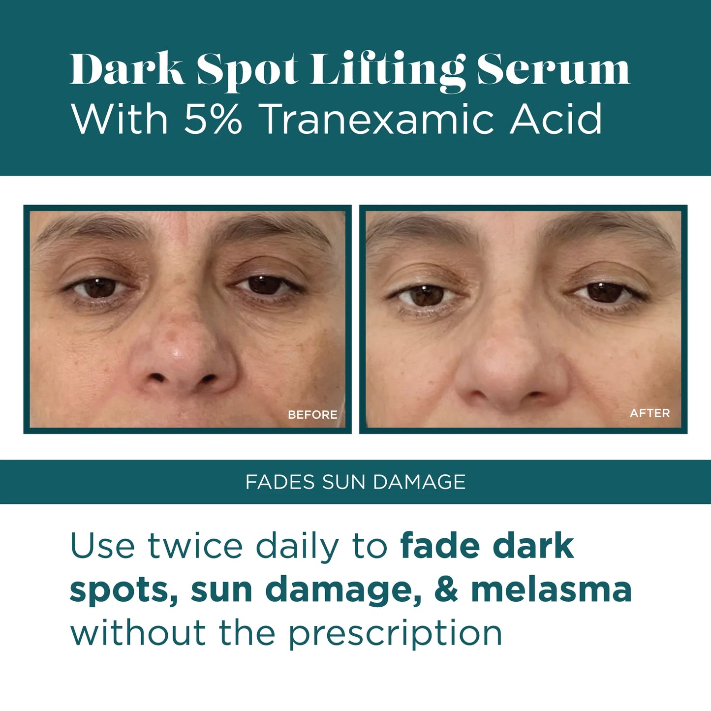VI Derm Dark Spot Lifting Serum 1.7fl oz