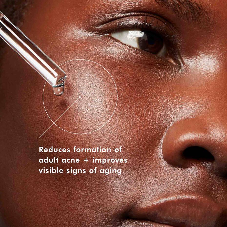 skinCeuticals Blemish + Age Defense